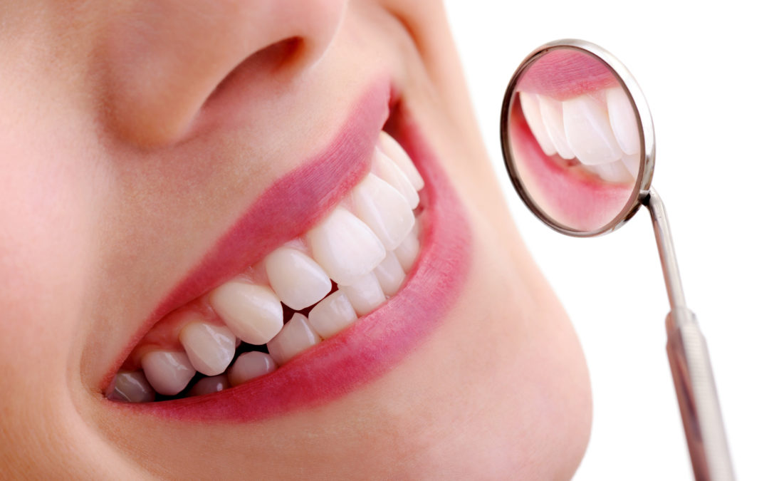 Comment prendre soin de ses implants dentaires ?